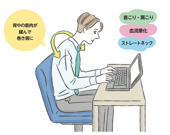 パソコン作業による首や肩への負担をイメージした画像
